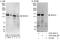Histone deacetylase 5 antibody, A303-463A, Bethyl Labs, Immunoprecipitation image 