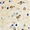 BLK Proto-Oncogene, Src Family Tyrosine Kinase antibody, orb335801, Biorbyt, Immunohistochemistry paraffin image 