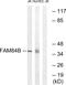 LRAT Domain Containing 2 antibody, GTX87774, GeneTex, Western Blot image 