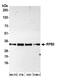 RNA Polymerase II Subunit C antibody, A303-771A, Bethyl Labs, Western Blot image 