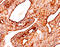 Keratin, type II cytoskeletal 8 antibody, AM33362PU-T, Origene, Immunohistochemistry paraffin image 