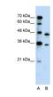 Phosphoribosyl Pyrophosphate Synthetase 2 antibody, NBP1-57669, Novus Biologicals, Western Blot image 