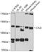 Ubiquitin carboxyl-terminal hydrolase CYLD antibody, 19-172, ProSci, Western Blot image 