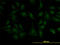 Zinc finger protein ZIC 4 antibody, LS-C105185, Lifespan Biosciences, Immunofluorescence image 
