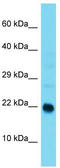 ADP Ribosylation Factor Like GTPase 9 antibody, TA343237, Origene, Western Blot image 