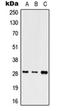 Short stature homeobox protein antibody, orb215518, Biorbyt, Western Blot image 
