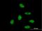 Zinc finger protein 496 antibody, H00084838-B01P, Novus Biologicals, Immunofluorescence image 