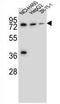 UDP Glucuronosyltransferase Family 2 Member B15 antibody, AP54455PU-N, Origene, Western Blot image 