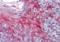 Zinc Finger MYM-Type Containing 4 antibody, orb89914, Biorbyt, Immunohistochemistry paraffin image 