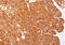 Melan-A antibody, AM50296PU-T, Origene, Immunohistochemistry frozen image 