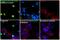 ATF4 antibody, PA5-36624, Invitrogen Antibodies, Immunofluorescence image 