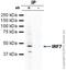 Interferon Regulatory Factor 7 antibody, ab62505, Abcam, Immunoprecipitation image 