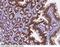 CD326 / EpCAM antibody, 90299-T60, Sino Biological, Immunohistochemistry frozen image 