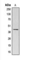 Actin Beta Like 2 antibody, orb393039, Biorbyt, Western Blot image 