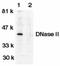 Deoxyribonuclease-2-alpha antibody, PA1-30778, Invitrogen Antibodies, Western Blot image 