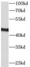 C-C Motif Chemokine Receptor Like 2 antibody, FNab01393, FineTest, Western Blot image 
