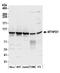Methylenetetrahydrofolate Dehydrogenase, Cyclohydrolase And Formyltetrahydrofolate Synthetase 1 antibody, A305-286A, Bethyl Labs, Western Blot image 
