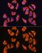 Sarcoglycan Alpha antibody, GTX66435, GeneTex, Immunocytochemistry image 