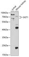 GGT antibody, GTX55638, GeneTex, Western Blot image 