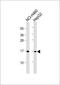 Interferon Induced Transmembrane Protein 3 antibody, M02265-1, Boster Biological Technology, Western Blot image 