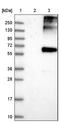 ALG9 Alpha-1,2-Mannosyltransferase antibody, NBP1-90191, Novus Biologicals, Western Blot image 
