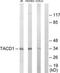 CD326 / EpCAM antibody, TA311989, Origene, Western Blot image 