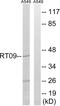 Mitochondrial Ribosomal Protein S9 antibody, abx014075, Abbexa, Western Blot image 