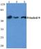 Frizzled Class Receptor 9 antibody, A08165-1, Boster Biological Technology, Western Blot image 