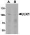 Unc-51 Like Autophagy Activating Kinase 1 antibody, LS-B10104, Lifespan Biosciences, Western Blot image 