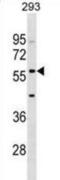 Interferon Induced Protein With Tetratricopeptide Repeats 2 antibody, abx029283, Abbexa, Western Blot image 