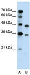Phosphoribosyl Pyrophosphate Synthetase 2 antibody, TA346065, Origene, Western Blot image 