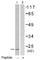 Gamma-synuclein antibody, ab55424, Abcam, Western Blot image 
