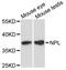 N-acetylneuraminate lyase antibody, A03704, Boster Biological Technology, Western Blot image 