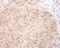 Cell division control protein 6 homolog antibody, A302-486A, Bethyl Labs, Immunohistochemistry frozen image 