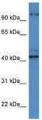 ATCAY Kinesin Light Chain Interacting Caytaxin antibody, TA343081, Origene, Western Blot image 