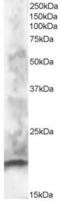 Calcium-binding protein 1 antibody, PA5-18082, Invitrogen Antibodies, Western Blot image 