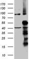 Translocase Of Inner Mitochondrial Membrane 50 antibody, TA811603S, Origene, Western Blot image 