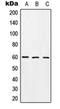 Ro60, Y RNA Binding Protein antibody, orb214611, Biorbyt, Western Blot image 