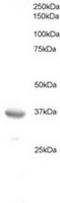 B-cell CLL/lymphoma 7 protein family member A antibody, TA302703, Origene, Western Blot image 