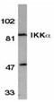 Inhibitor of nuclear factor kappa-B kinase subunit alpha antibody, TA305994, Origene, Western Blot image 