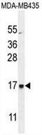 Cilia And Flagella Associated Protein 410 antibody, AP51137PU-N, Origene, Western Blot image 