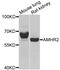 Anillin Actin Binding Protein antibody, PA5-76012, Invitrogen Antibodies, Western Blot image 