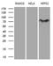 MYCN Proto-Oncogene, BHLH Transcription Factor antibody, M00032, Boster Biological Technology, Western Blot image 