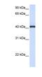 Fc Receptor Like A antibody, NBP1-62325, Novus Biologicals, Western Blot image 