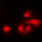 Serine/Threonine Kinase 11 antibody, LS-C354098, Lifespan Biosciences, Immunofluorescence image 