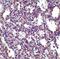 Stromal interaction molecule 2 antibody, PA5-20373, Invitrogen Antibodies, Immunohistochemistry paraffin image 