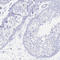 Solute Carrier Family 2 Member 1 antibody, HPA031345, Atlas Antibodies, Immunohistochemistry paraffin image 