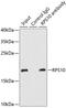 Ribosomal Protein S10 antibody, GTX33475, GeneTex, Immunoprecipitation image 
