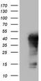 Tet Methylcytosine Dioxygenase 1 antibody, TA802183BM, Origene, Western Blot image 