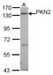 Protein Kinase N2 antibody, NBP1-31367, Novus Biologicals, Western Blot image 